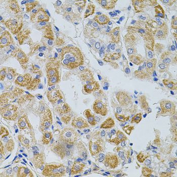 Immunohistochemistry - PCSK9 antibody (144-07860)
