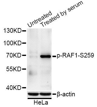 Western blot - Phospho-RAF1-S259 pAb (144-50497)