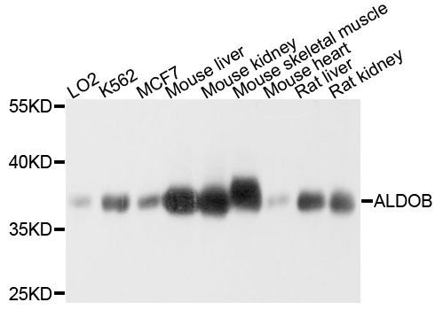 Western blot - ALDOB Polyclonal Antibody (144-03728)