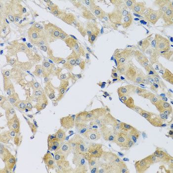 Immunohistochemistry - ABCF2 antibody (144-04365)