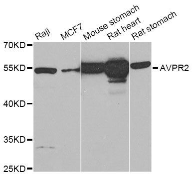 Western blot - SMYD1 Polyclonal Antibody (144-02340)