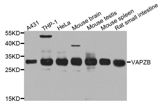 Western blot - CAPZB Polyclonal Antibody (144-08106)