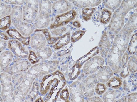 Immunohistochemistry - ITGAV antibody (144-02091)