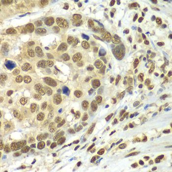 Immunohistochemistry - HDAC2 Polyclonal Antibody (144-02084)