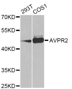 Western blot - AVPR2 Antibody (144-07879)