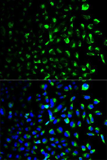 Western blot - HK1 Polyclonal Antibody (144-01054)