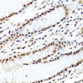 Immunohistochemistry - METTL3 Polyclonal Antibody (144-08370)