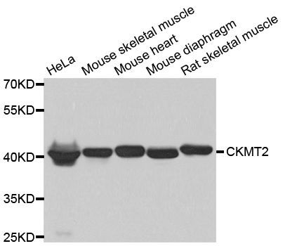 Western blot - CKMT2 antibody (144-08088)