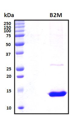 SDS-PAGE