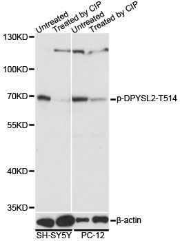 Western blot - Phospho-DPYSL2-T514 pAb (144-61537)