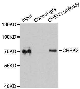 Immunoprecipitation - CHEK2 Polyclonal Antibody (144-60023)