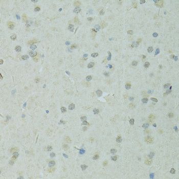 Immunohistochemistry - TRIM28 antibody (144-02245)