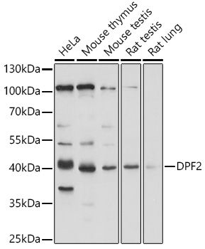 Western blot
