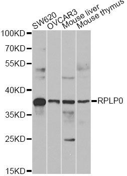 Western blot - RPLP0 antibody (144-013633)