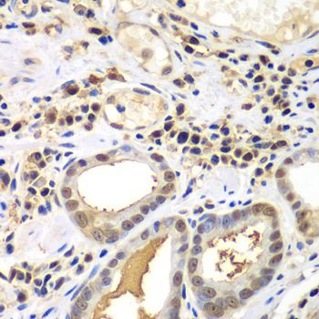 Immunohistochemistry - PSME2 antibody (144-013631)