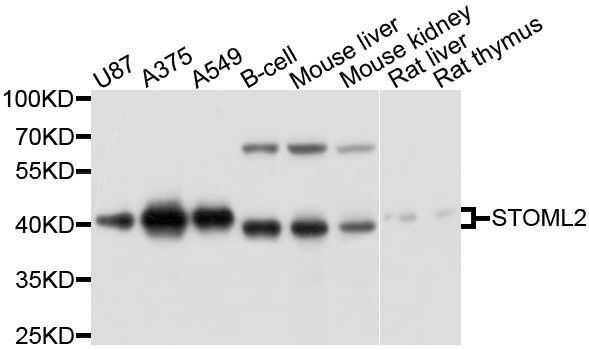 Western blot - STOML2 Polyclonal Antibody (144-10398)
