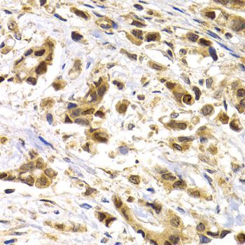 Immunohistochemistry - MAGEA1 antibody (144-05470)