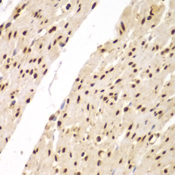 Immunohistochemistry - SUPT20H Polyclonal Antibody (144-07374)