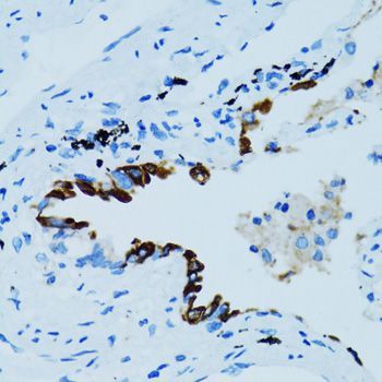 Immunohistochemistry - CTSE antibody (144-02678)