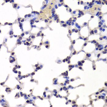 Immunohistochemistry - INTS6 Antibody (144-06634)
