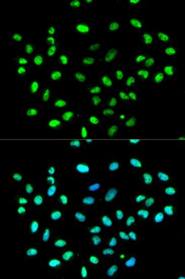 Immunofluorescence - HNRNPK antibody (144-01701)