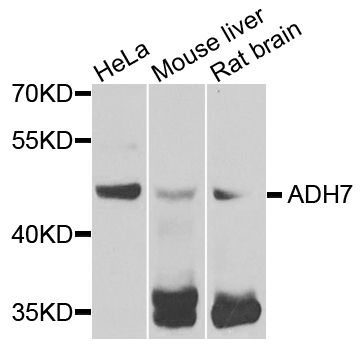 Western blot - ADH7 antibody (144-07871)