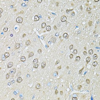 Immunohistochemistry - PSMB1 Polyclonal Antibody (144-01043)