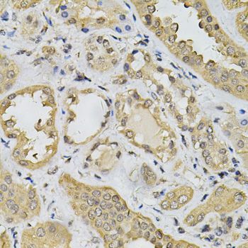 Immunohistochemistry - N6AMT1 Antibody (144-07201)