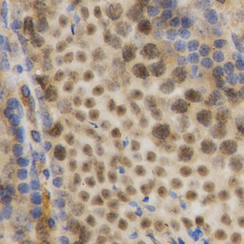 Immunohistochemistry - ELAVL1 Polyclonal Antibody (144-01608)