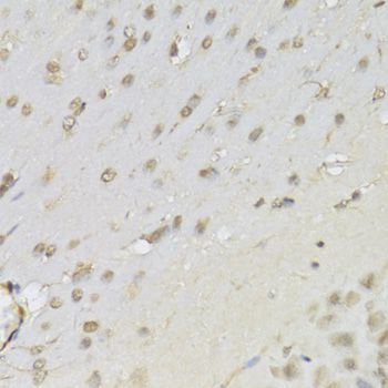 Immunohistochemistry - RUNX1 Antibody (144-02055)