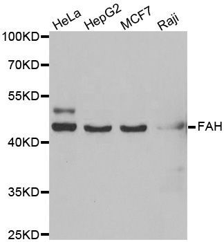 Western blot - FAH antibody (144-06586)
