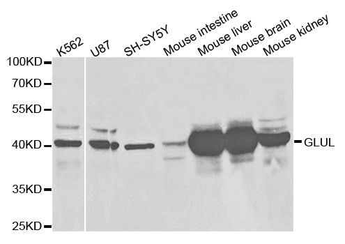 Western blot - [KO Validated] GLUL Polyclonal Antibody (144-05437)