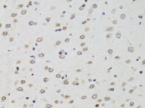 Immunohistochemistry - [KO Validated] TMPO Polyclonal Antibody (144-02534)