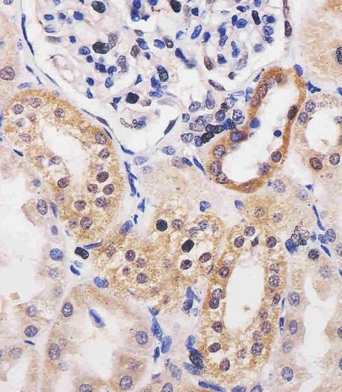IHC-P