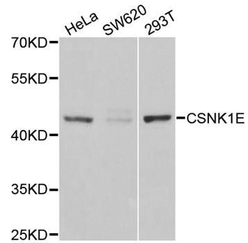 Western blot - [KO Validated] CSNK1E Polyclonal Antibody (144-01796)