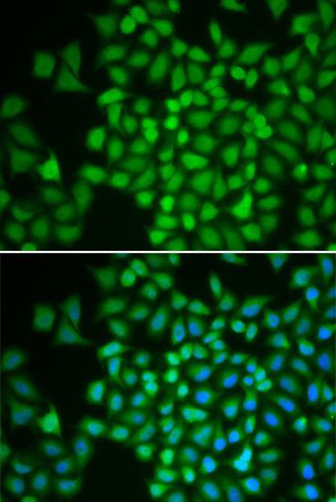 Immunofluorescence - COPS5 Polyclonal Antibody (144-013401)