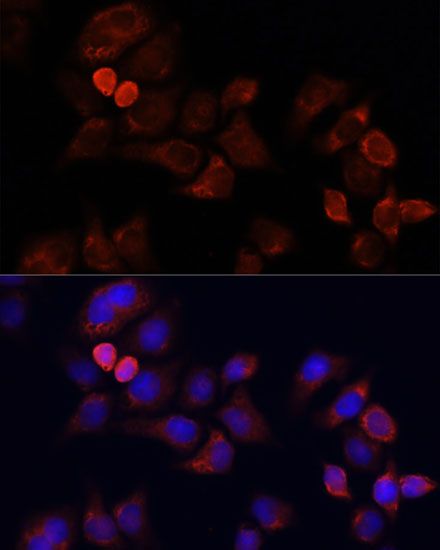 Immunofluorescence - EIF3J Polyclonal Antibody (144-08637)