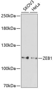 Western blot