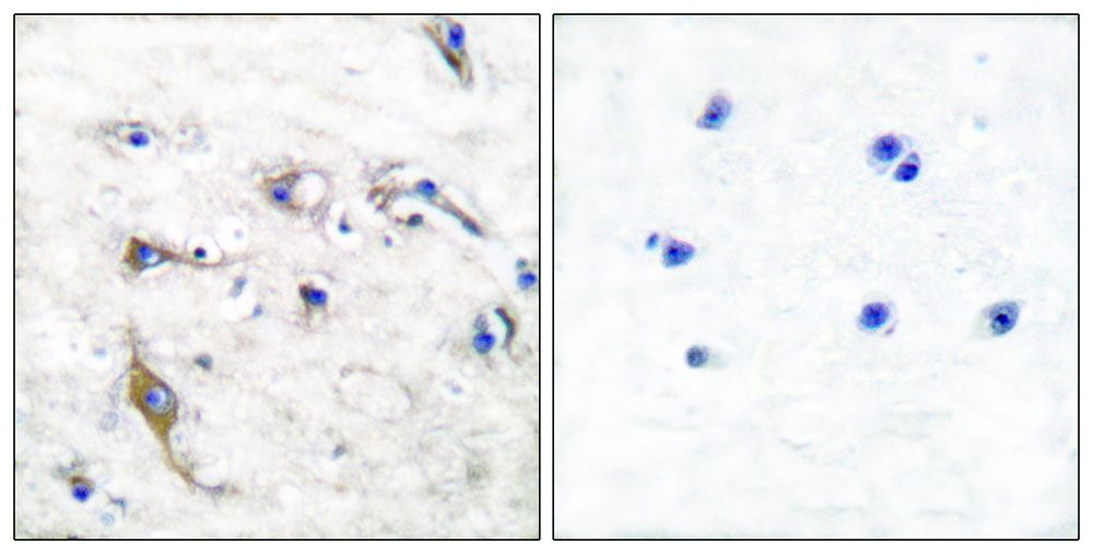 IHC