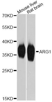 Western blot - ARG1 Polyclonal Antibody (144-01847)
