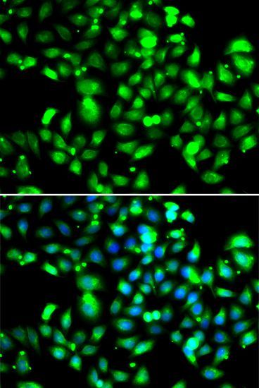 Immunofluorescence - GBP1 antibody (144-06911)
