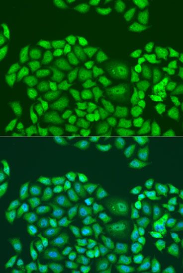 Immunofluorescence - SMN2 Polyclonal Antibody (144-012519)