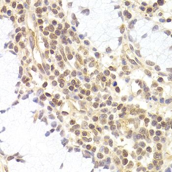 Immunohistochemistry - PHC1 antibody (144-05843)