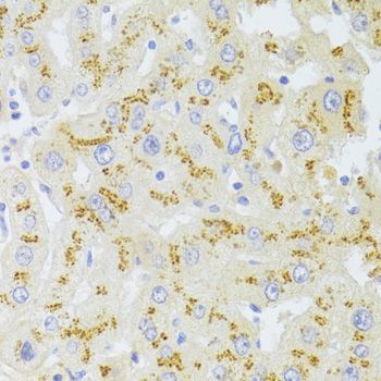Immunohistochemistry - FAS Polyclonal Antibody (144-00233)