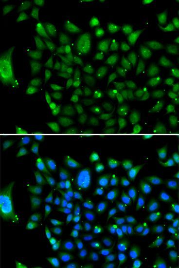 Immunofluorescence - NCOR1 antibody (144-07046)