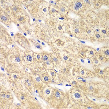 Immunohistochemistry - ACADS Polyclonal Antibody (144-60044)