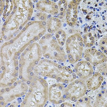 Immunohistochemistry - ALDH1A1 antibody (144-01802)
