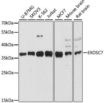 Western blot - EXOSC7 antibody (144-09689)
