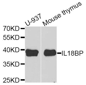 Western blot - IL18BP antibody (144-06445)