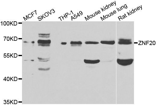 Western blot - ZNF20 antibody (144-07346)
